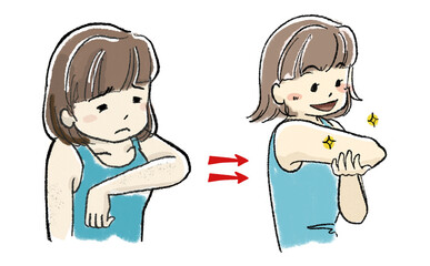ムダ毛が気になる女性と脱毛後に肌がきれいになって喜ぶ女性のイラスト