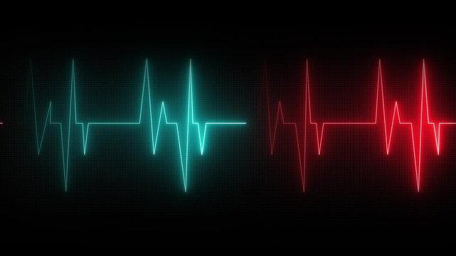 Digital minimalist neon cardiogram showing one heart cycle. Correct medical image of a cardiogram with the appropriate teeth and segments. Black background.