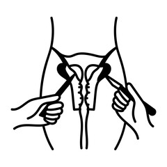 Doodle icon depicting hysteroscopy surgery procedure 

