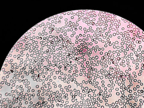 Human blood under a microscope. You can see erythrocytes - red blood cells (RBC).The red color is given to them by the ferrous atom of iron, which is able to bind oxygen.