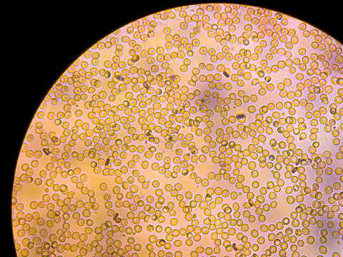 Human blood under a microscope. You can see erythrocytes - red blood cells (RBC).The red color is given to them by the ferrous atom of iron, which is able to bind oxygen.