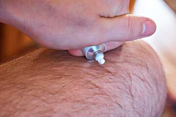 A man squeezes out a white anti-inflammatory gel cream from a tube onto his leg. Treatment of arthrosis and arthritis, anti-inflammatory ointment for joint treatment, close-up, medicine