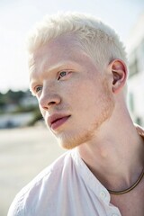 A beautiful young man with albinism, featuring fair skin, white hair, and delicate features. He looks confident and serene, with soft natural lighting highlighting her unique beauty