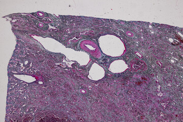 Pathology and Histology Tissue of Mammals under microscope.