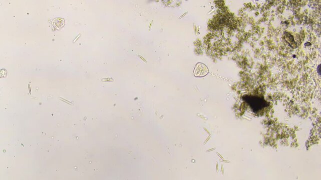 Vorticella and green algae in freshwater-100X magnification