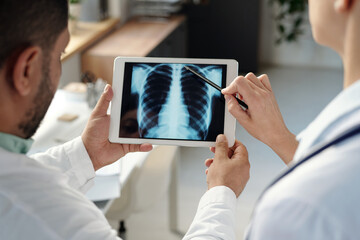 Over shoulder close up of two doctors examining chest X ray images on tablet screen with hand...