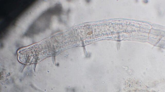  Worm of the family Naididae under the microscope, Naididae,   clitellate,  oligochaete,  worms, TICINO RIVER, Italy , internal stomach, intestine in transparency, microscope