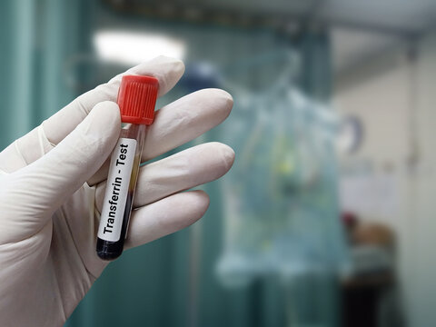 Biochemist or Scientist holds blood sample for Transferrin (Iron deficiency anemia, TIBC) test. Medical test tube in laboratory background.