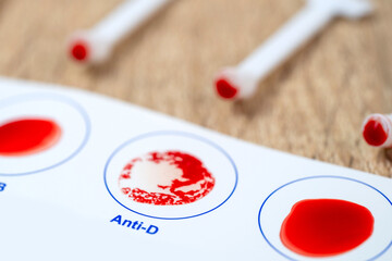 Blood typing test card with Anti-B, Anti-D result, diagnostics and health awareness, personal...