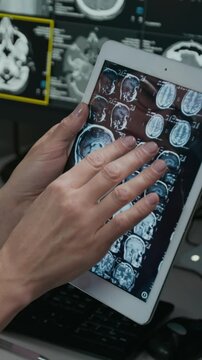 Vertical closeup of hands of anonymous female radiologist scrutinizing brain MRI scan on digital tablet, zooming in on sagittal planes to detect signs of tumor, aneurism, abnormality or dementia
