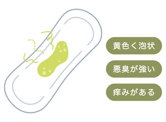 緑っぽい色のおりもの　女性の健康　ナプキン