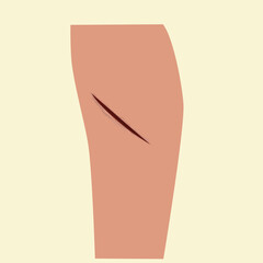 injured hand. Hand blood injury.