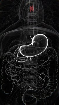 Esophageal Cancer in Vertical HQ Video | Esophageal Cancer Indication X-Ray Video