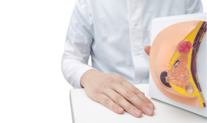 Doctor showing breast tumor or cancer on anatomical model of breast for women's awareness of prevention and treatment of breast diseases, isolated on transparent background with PNG file