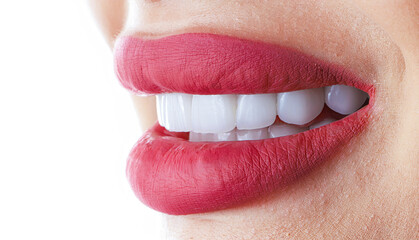 red lips and ceramic veneer teeth