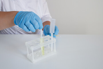 Doctor making express urinalysis using strips in clinical laboratory