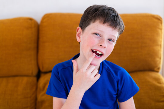 Young boy at home showing a missing milk tooth