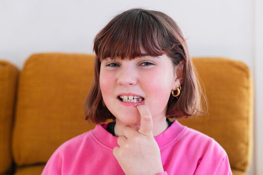 Schoolchildren with Milk Teeth Falling Out and Freckles
