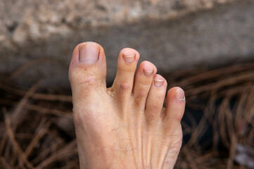 Photos of feet on stone