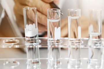 Bottles and transparent dishes are used in scientific and medical experiments, the use of chemicals creates medical research.