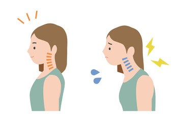 理想的な良い姿勢で健康な女性と、姿勢が悪くストレートネックやスマホ首で痛みを感じている女性のイラストのセット