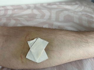 Close-up of a forearm with a bandage applied to a minor wound, indicating healing. The skin shows...