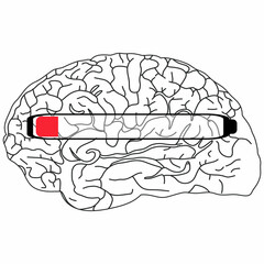 The image shows a black and white illustration of a brain with a horizontal progress bar partially filled in red.