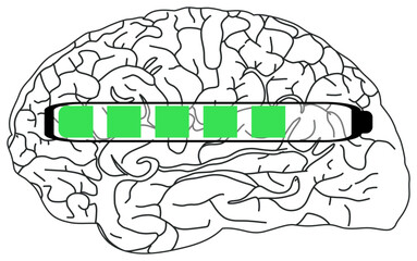 The sticker image shows a black and white illustration of a brain with a horizontal progress bar partially filled in green.