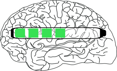 The image shows a black and white illustration of the brain with a horizontal progress bar partially filled with green.