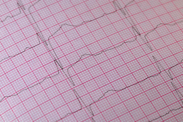 Electrocardiogram close-up. Heart rhythm monitoring