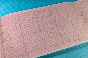 Checking heart health using a cardiogram. Paper tape with electrocardiogram