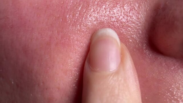 A close-up of a woman applying face oil to her oily skin, highlighting visible pores and skin texture, as part of a skincare routine