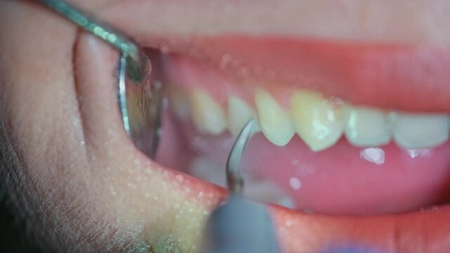 Professional dentist treating a patient in a modern dental clinic. The patient sits with an open mouth as the dentist drills and cleans teeth with water, ensuring proper dental care and hygiene.