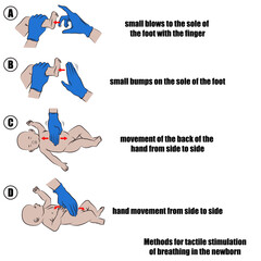 methods for tactile stimulation of breathing in the newborn.