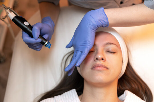 Skincare treatment session featuring microneedling technique on a client's face