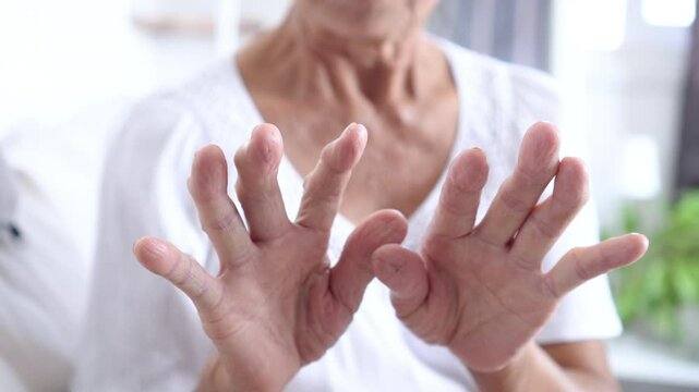 Senior woman showing hand with inflammatory osteoarthritis in the joints of her fingers