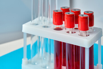 A row of red tubes with red caps sit on a white tray. The tubes are filled with blood and are arranged in a row