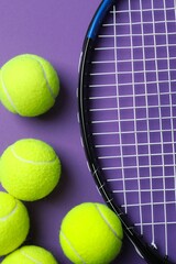Tennis racket and balls on a color background