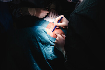 A medical team performing a detailed surgery, utilizing specialized instruments