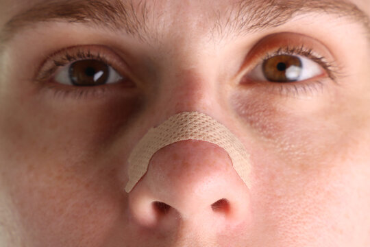 Woman with a nasal strip in the nose apply. Close view of a nasal strip in the nose