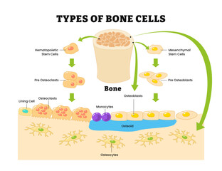 Different types of human bone cells diagram, labeled hematopoietic stem cell, pre osteoclasts, lining cell, monocytes, osteoid, osteocytes, mesenchymal, bone tissue, bone matrix. © vesvocrea