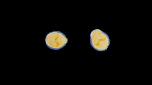 Lecithotrophic larva Bryozoa or Ectoprocta under a microscope. Coronate larva. Sample found in White sea.