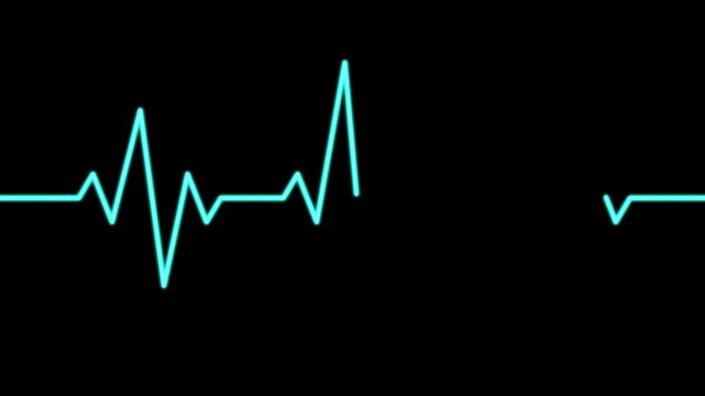 Electrocardiogram animation on a black background. 4K Video