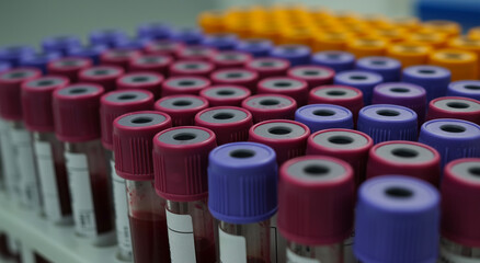 Blood Test Tubes in Laboratory, Medical Testing Vials with Colored Caps, Healthcare Research and Diagnostic Equipment, Clinical Analysis Concept