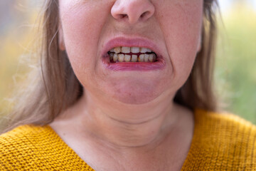 Furious woman staring aggressively, Middle-aged woman making disgusted face outdoors, Facial...