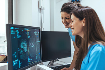 Two Nurses Examining Brain Scans on Medical Computers in a Professional Setting