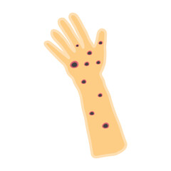 Monkeypox virus on skin 