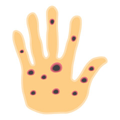 Monkeypox virus on skin 