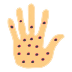 Monkeypox virus on skin 