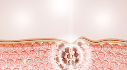 3D illustration of laser treatment penetrating skin layers, stimulating collagen regeneration and firming skin cells. A concept for skincare, anti-aging, and dermatology treatments.